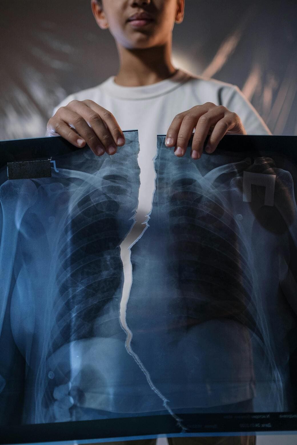 Race-Based Medicine: The Hidden Bias Hurting Black Patients